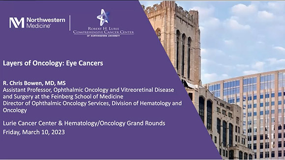 Layers of Oncology: Eye Cancers