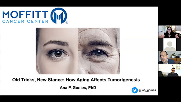 Age-Related Metabolic Changes Drive Tumor Progression