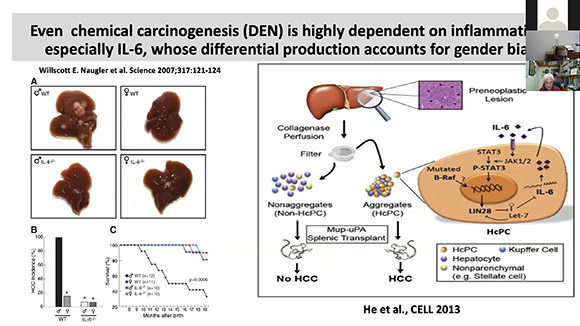 Inflammation, Metabolism and Immunity in Liver Cancer: From Pathogenesis to Treatment